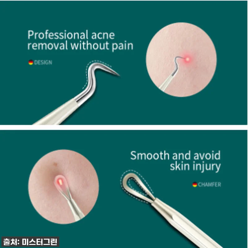 미스터그린 여드름 압출기 핀셋 MR-2177 코피지압출기 압출바늘 독일의료용 스테인레스 10 미스터그린 여드름 압출기 핀셋 MR- 관련 이미지 2