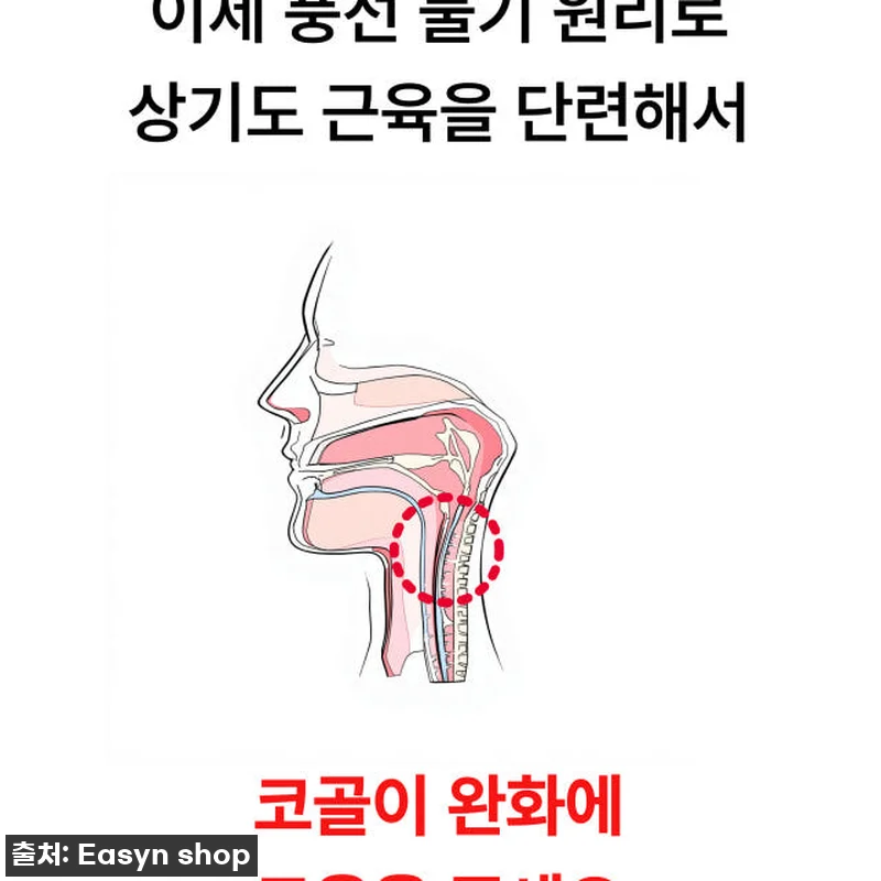 이지앤안고라 코골이 방지 기구 사용후 관련 이미지 9
