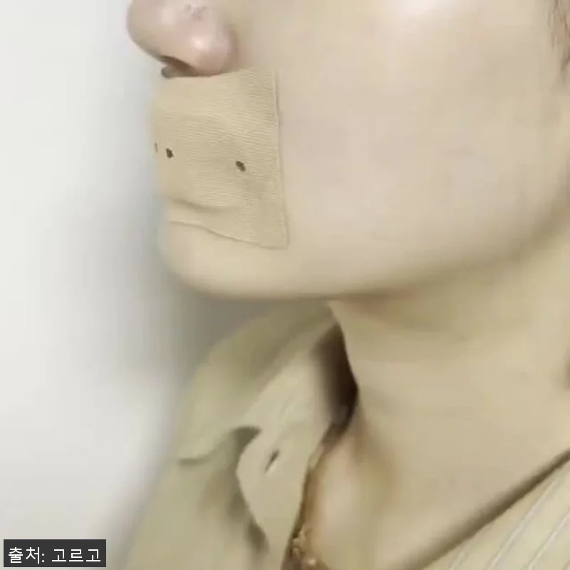 립앤숨 코골이 방지 입벌림 밴드 사용 관련 이미지 6
